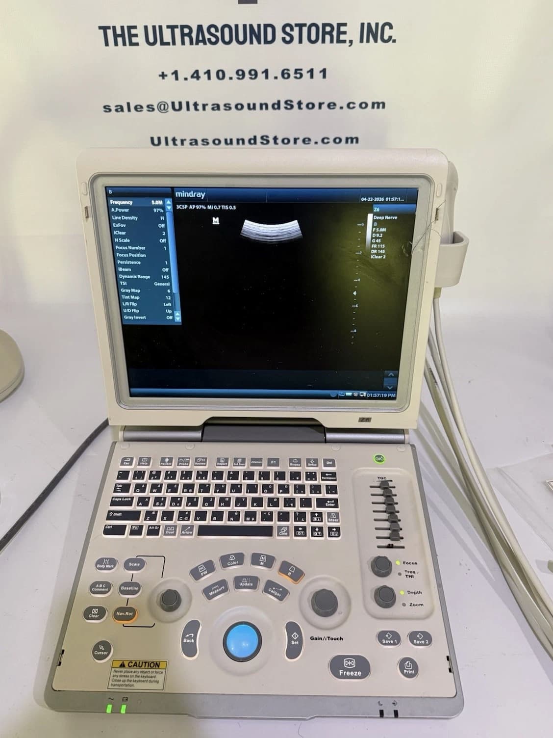Mindray Z6 Ultrasound Machine w/ 2 Probes (7L4P & 3C5P) 2014 Color Doppler